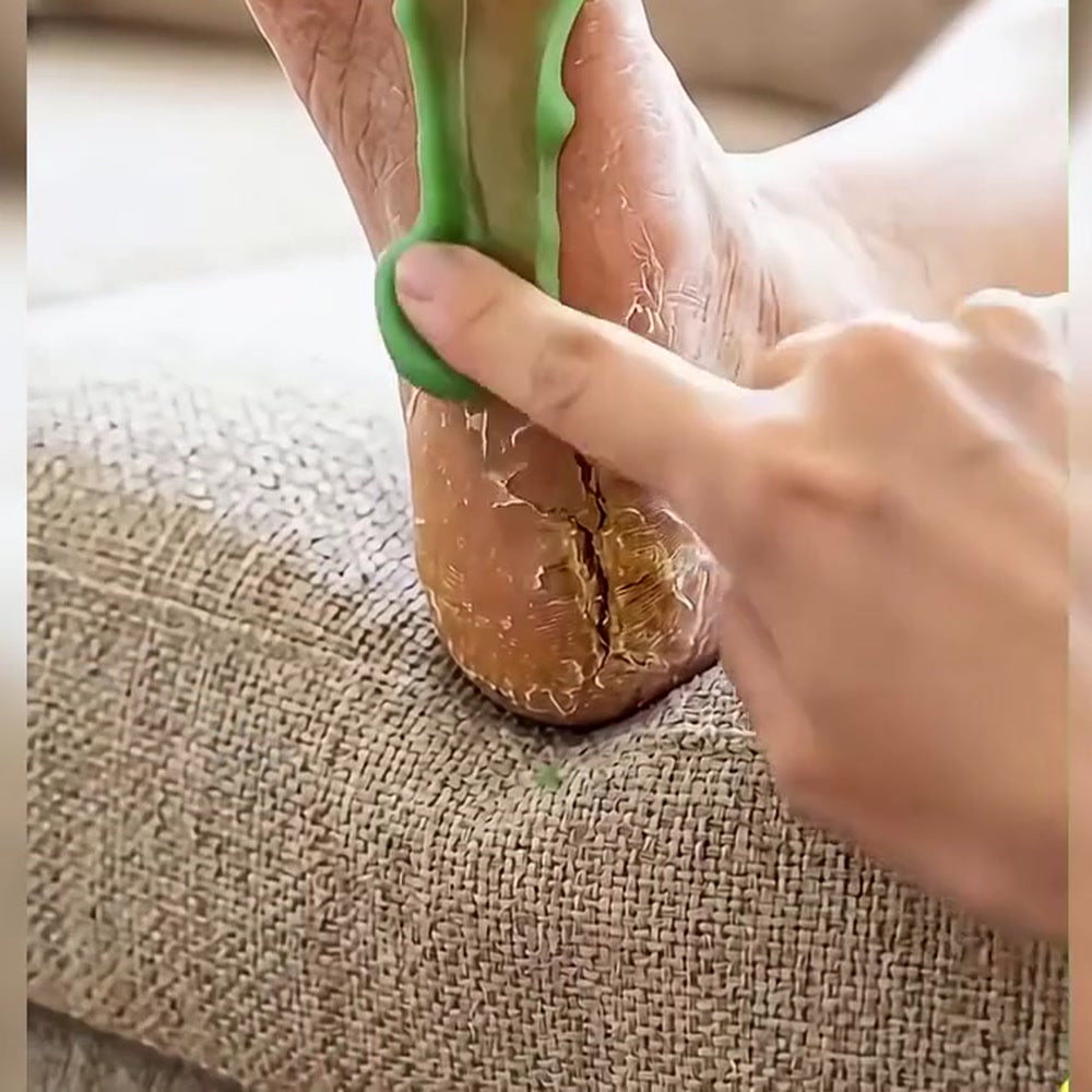 Application du baume sur un talon crevassé